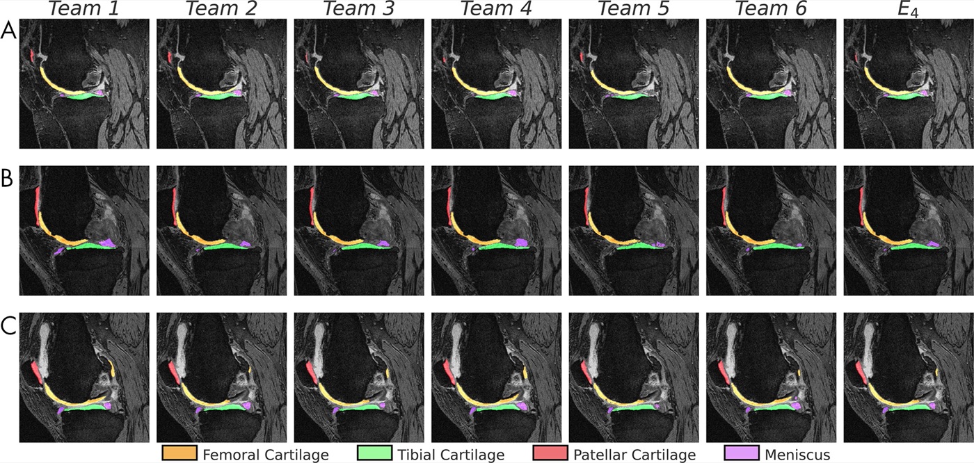 AI MSK Tumor Classification
